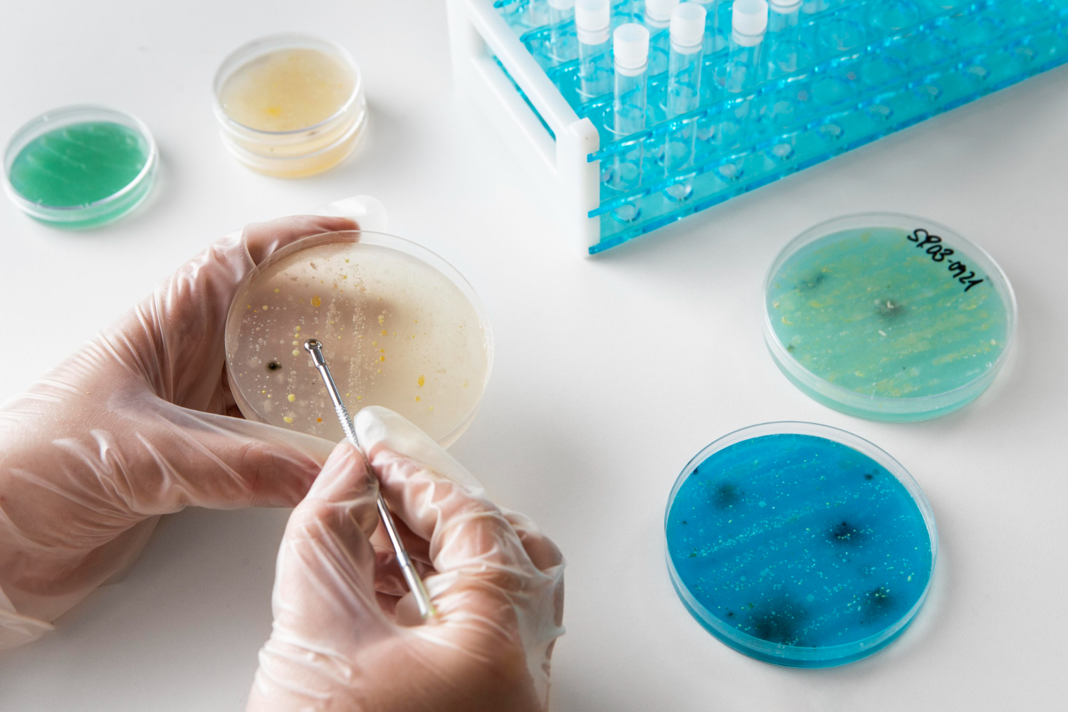 การตรวจ DNA เพื่อประเมินความเสี่ยงภูมิแพ้ทางพันธุกรรม: ก้าวใหม่สู่การดูแลสุขภาพเชิงป้องกัน
