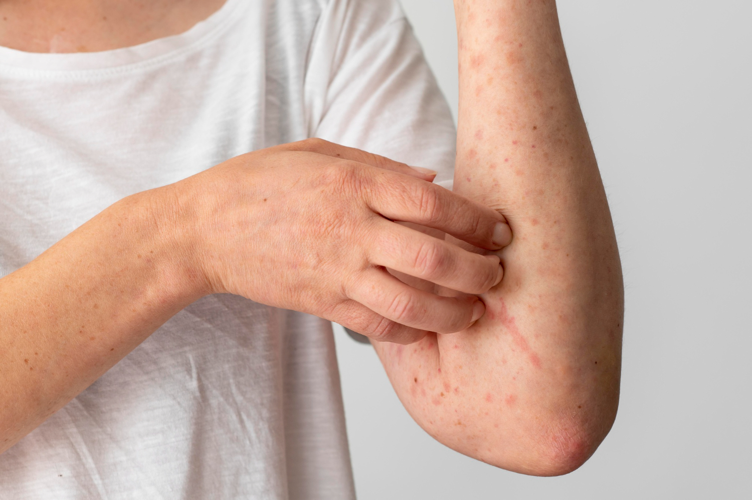 ภูมิแพ้คืออะไร? สาเหตุและวิธีรับมืออย่างเหมาะสม